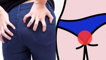 Butt-Pain during Period