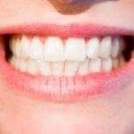 Top 7 Ways In Keeping Our Teeth Healthy