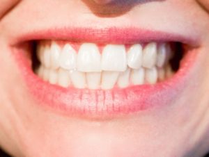 Top 7 Ways In Keeping Our Teeth Healthy