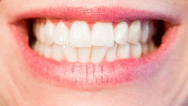 Top 7 Ways In Keeping Our Teeth Healthy