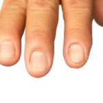 Nails and hair getting weaker due to protein deficiency